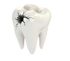 补牙洞价格_补牙洞图片